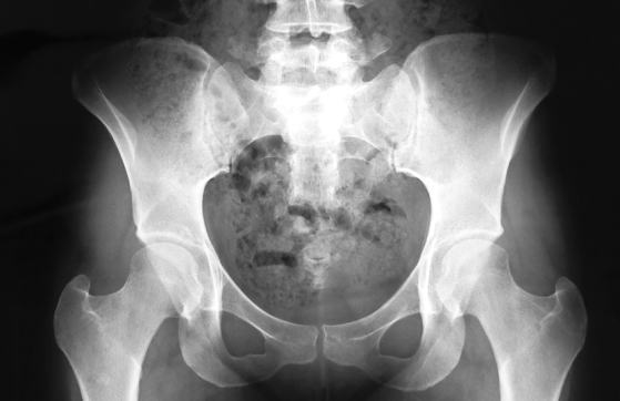 骨盤あそび 画像